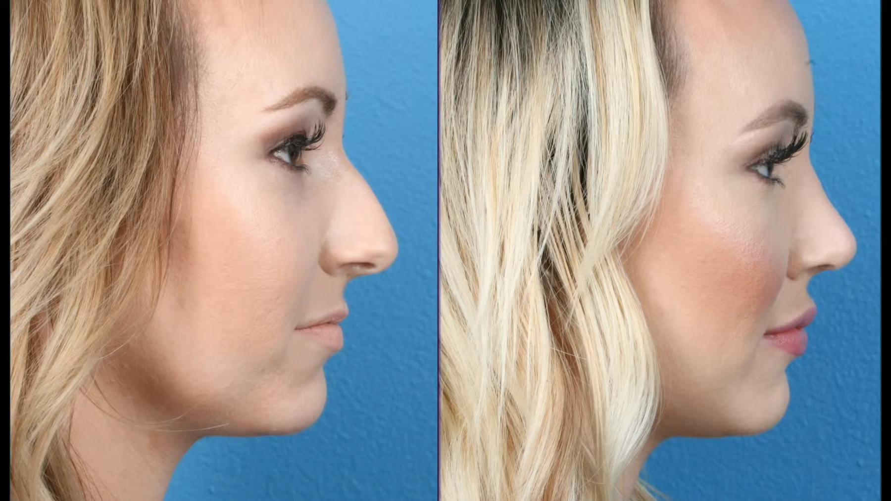 Holcomb - Kreithen Plastic Surgery & Medspa