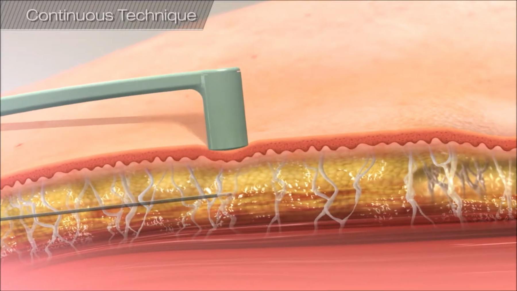 Holcomb - Kreithen Plastic Surgery & Medspa