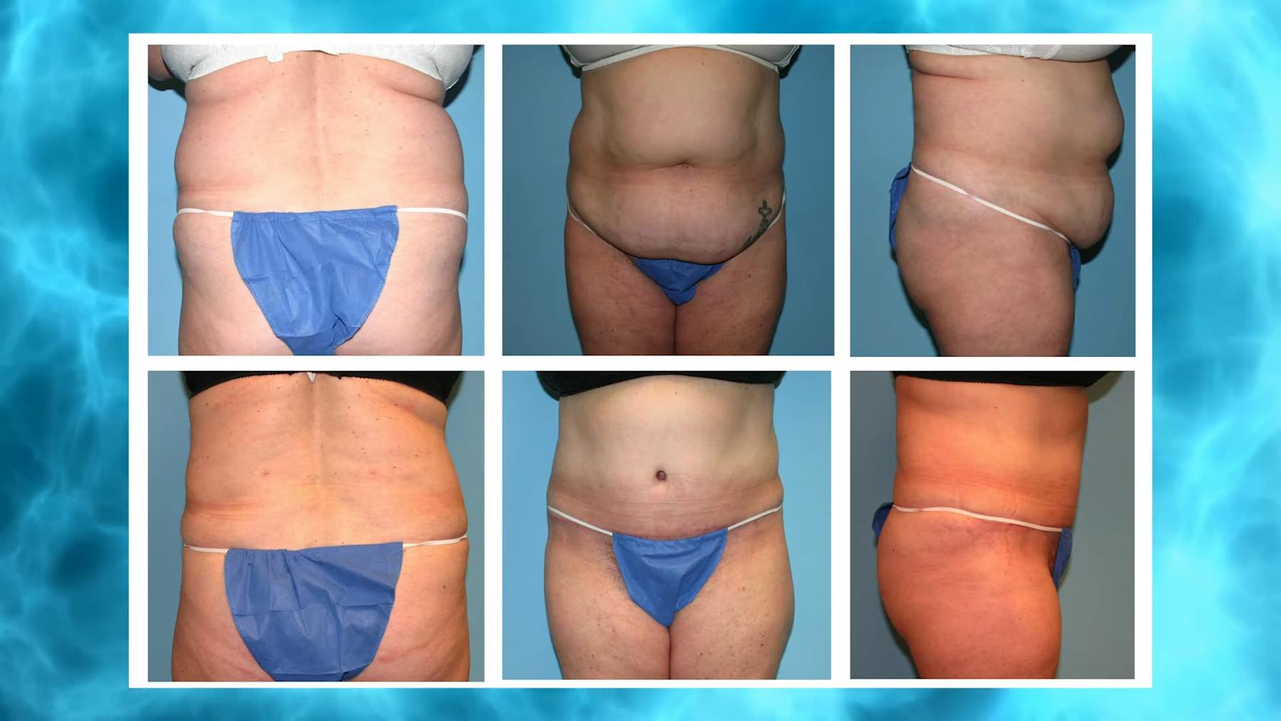 Holcomb - Kreithen Plastic Surgery & Medspa