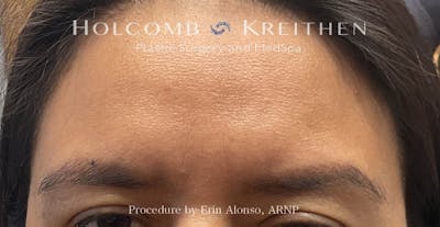 Tattoo Removal Before & After Gallery - Patient 722706 - Image 1