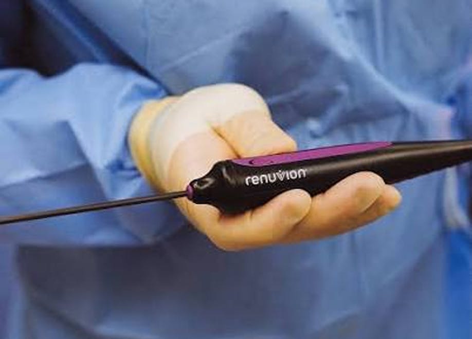 Dr Holcomb Participates in Clinical Study Evaluating the Renuvion Dermal Handpiece