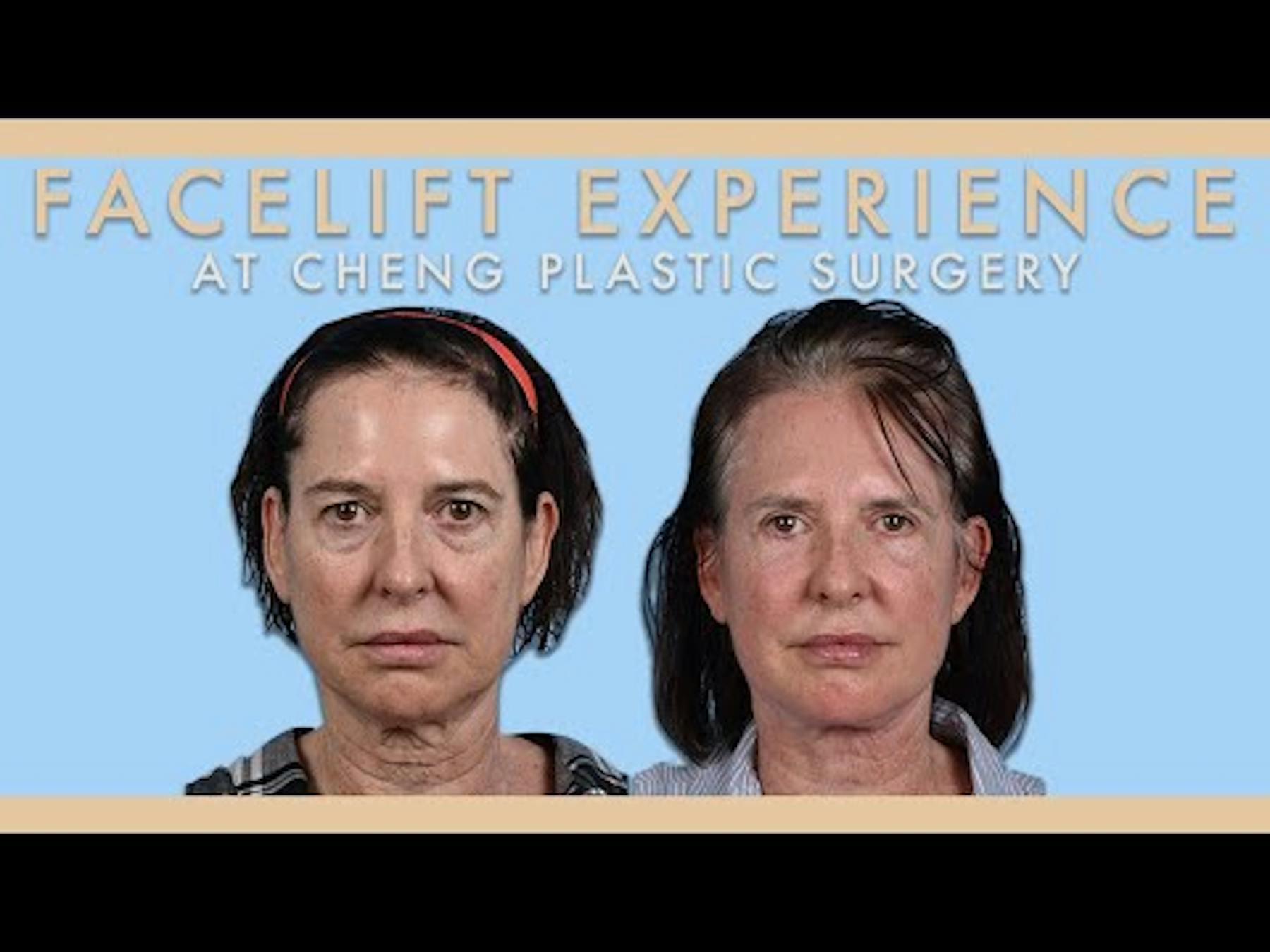 Cheng Plastic Surgery