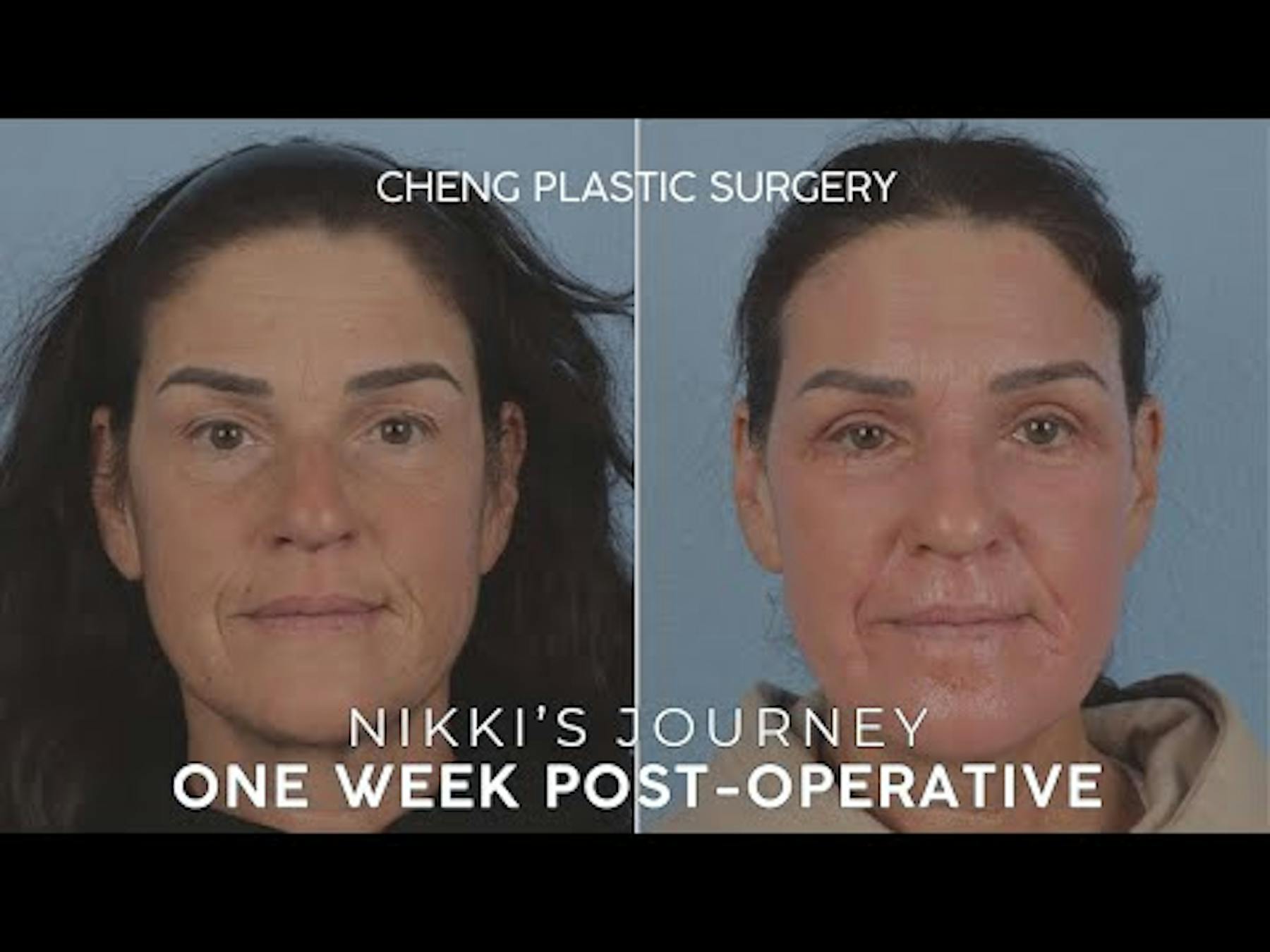 Cheng Plastic Surgery