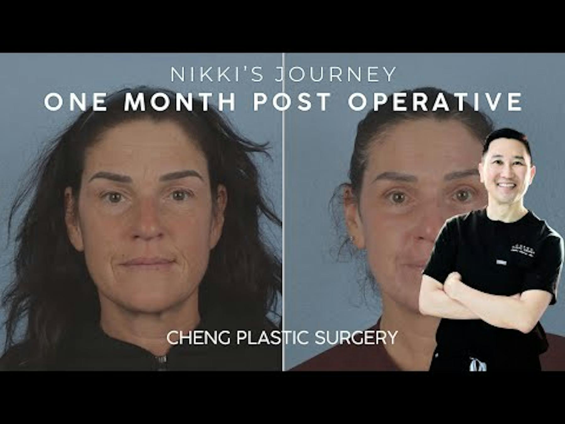 Cheng Plastic Surgery