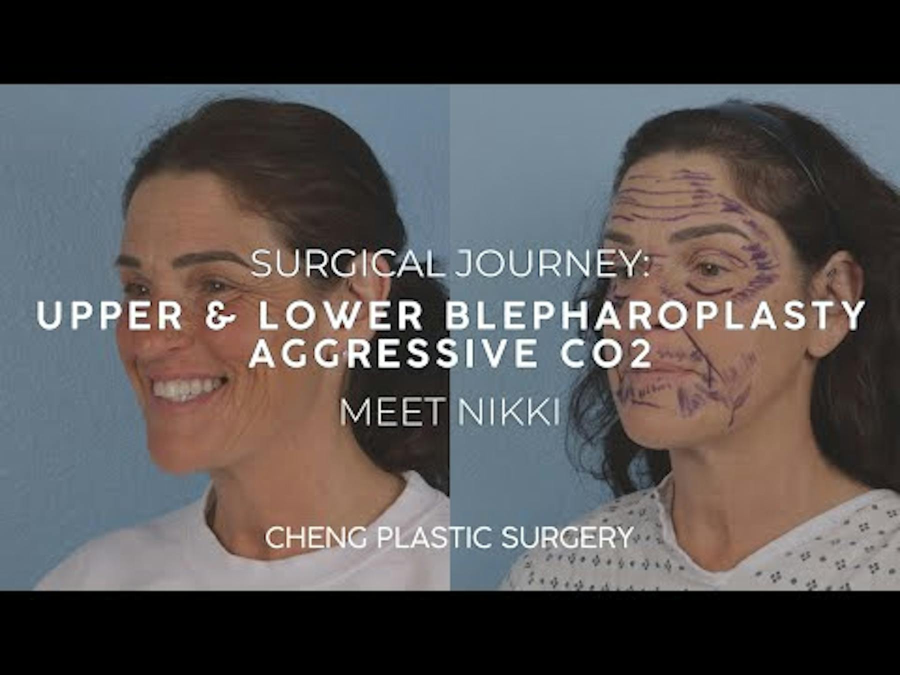 Cheng Plastic Surgery