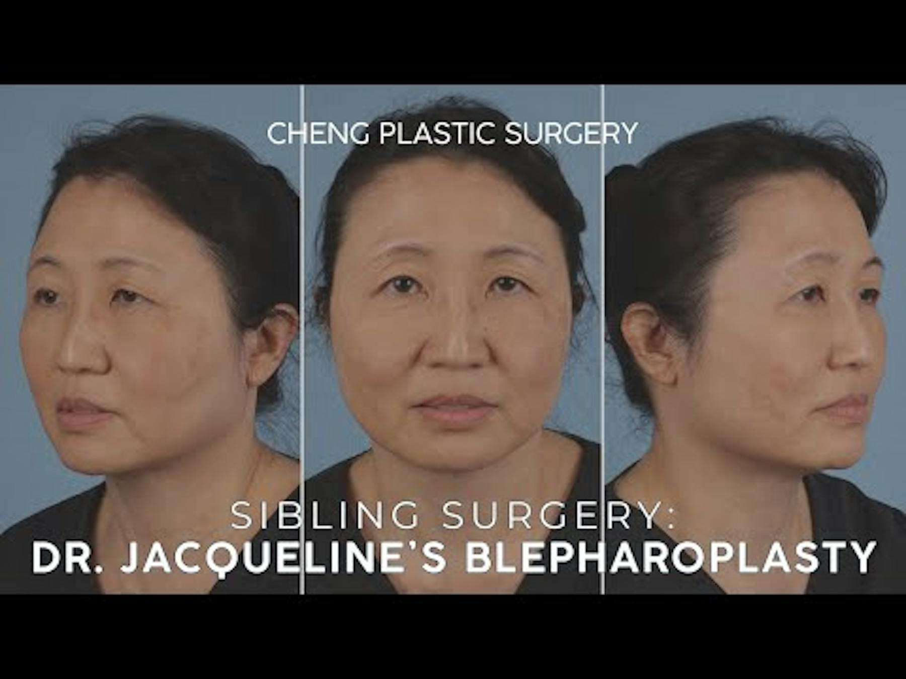 Cheng Plastic Surgery