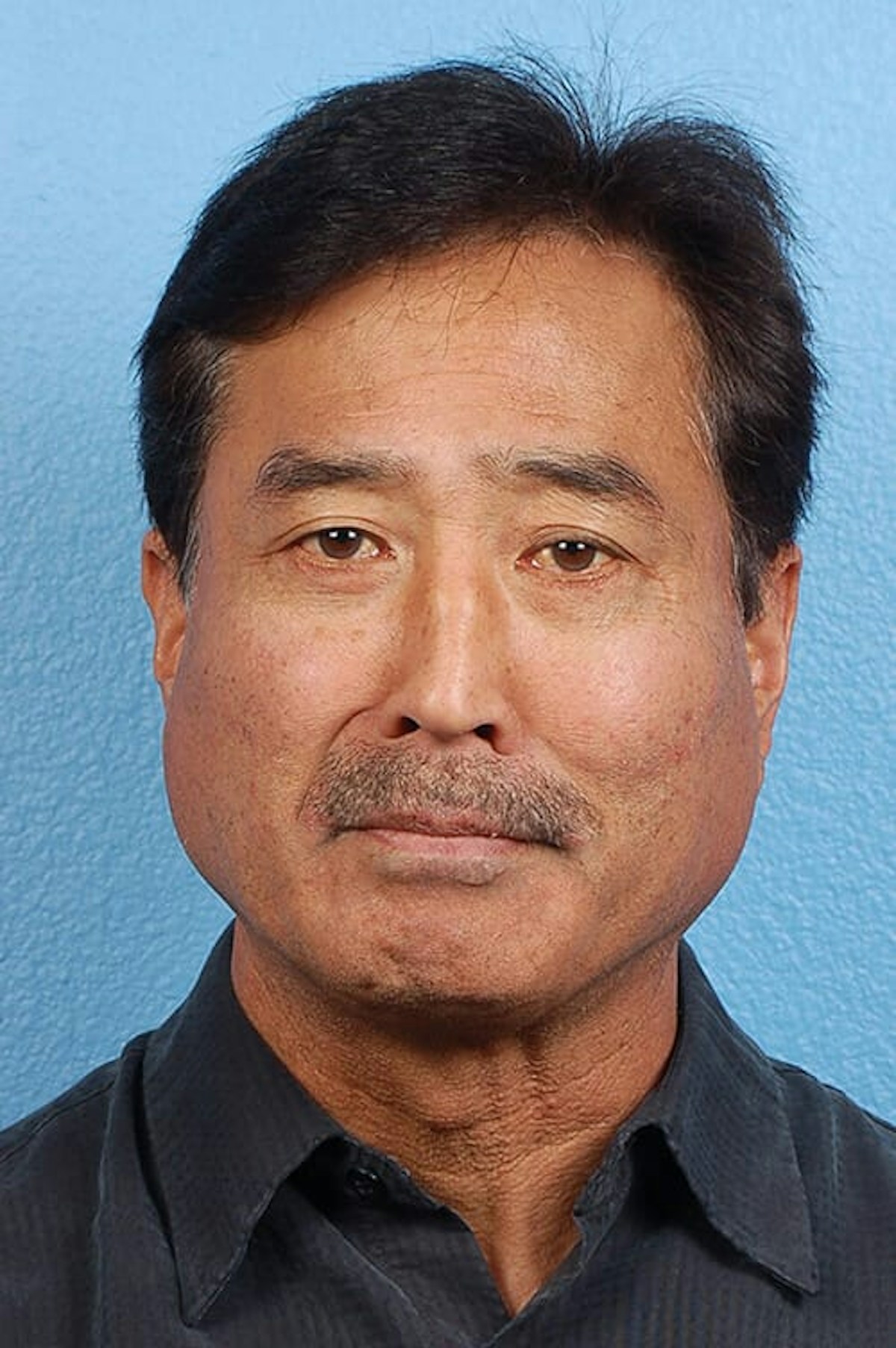Blepharoplasty Before & After Gallery - Patient 481320 - Image 2