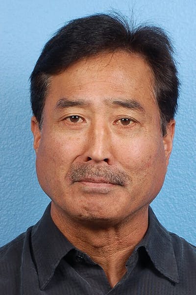 Blepharoplasty Before & After Gallery - Patient 481320 - Image 2