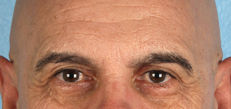 Hidden Patients Before & After Gallery - Patient 421996 - Image 1