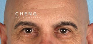 Hidden Patients Before & After Gallery - Patient 421996 - Image 1