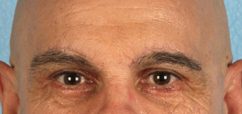 Hidden Patients Before & After Gallery - Patient 421996 - Image 2