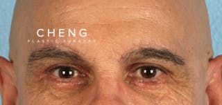 Hidden Patients Before & After Gallery - Patient 421996 - Image 2