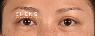 Hidden Patients Before & After Gallery - Patient 136681 - Image 2