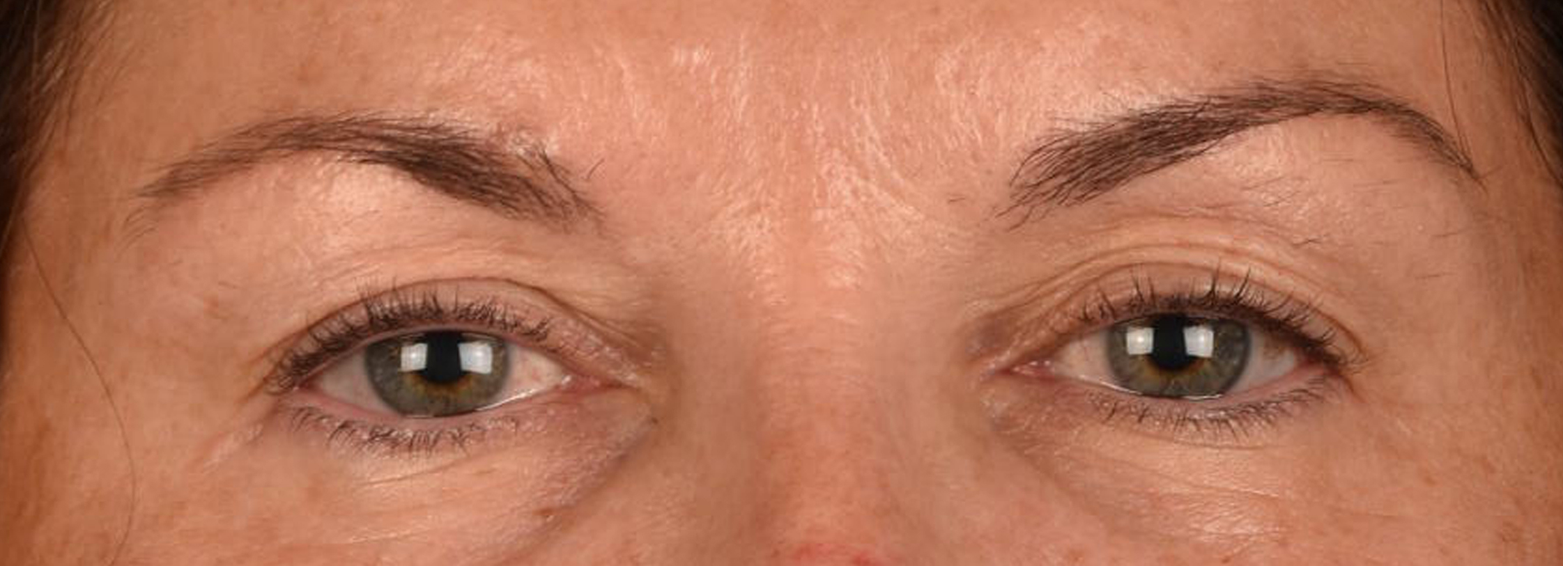 Hidden Patients Before & After Gallery - Patient 262469 - Image 1