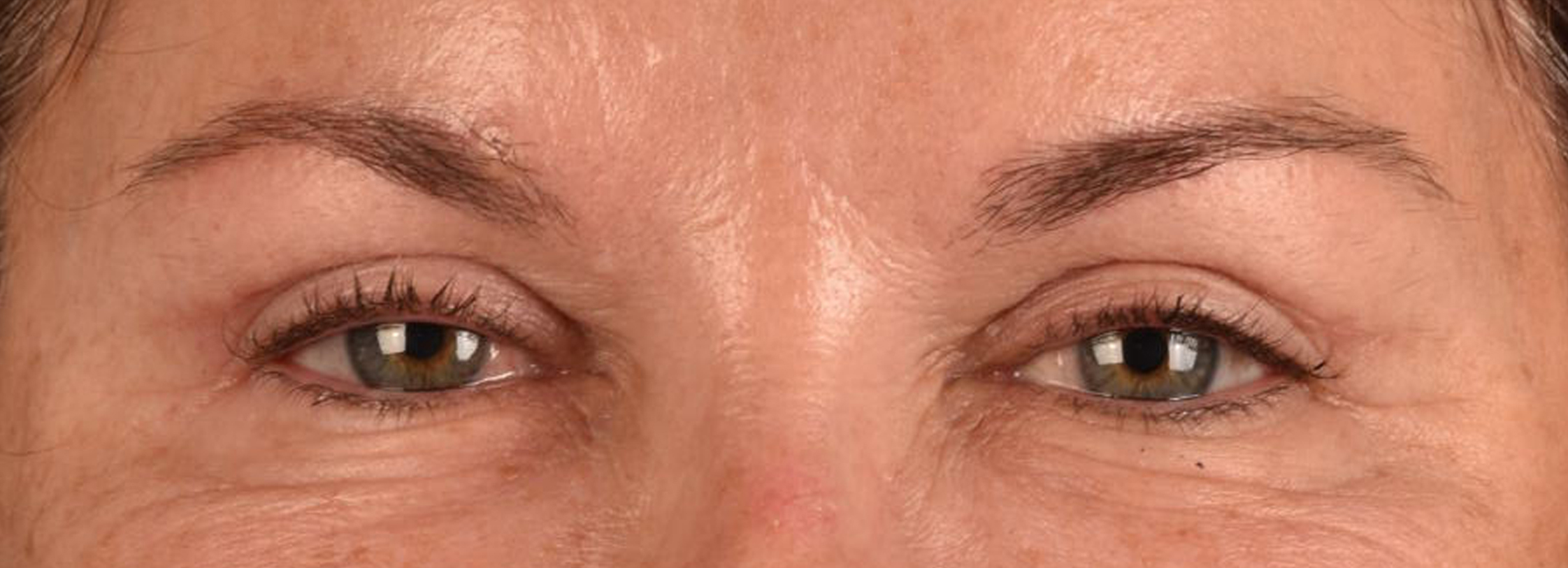 Hidden Patients Before & After Gallery - Patient 262469 - Image 2