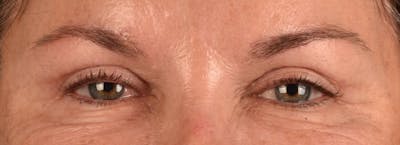 Hidden Patients Before & After Gallery - Patient 262469 - Image 2