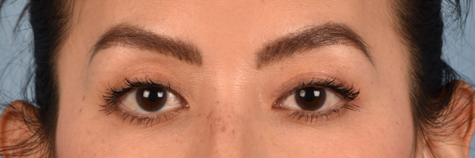 Hidden Patients Before & After Gallery - Patient 295978 - Image 2