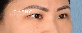 Hidden Patients Before & After Gallery - Patient 181350 - Image 7