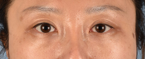 Hidden Patients Before & After Gallery - Patient 300838 - Image 2