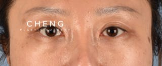 Hidden Patients Before & After Gallery - Patient 300838 - Image 2