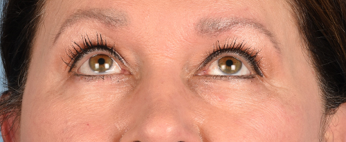 Hidden Patients Before & After Gallery - Patient 140219 - Image 3