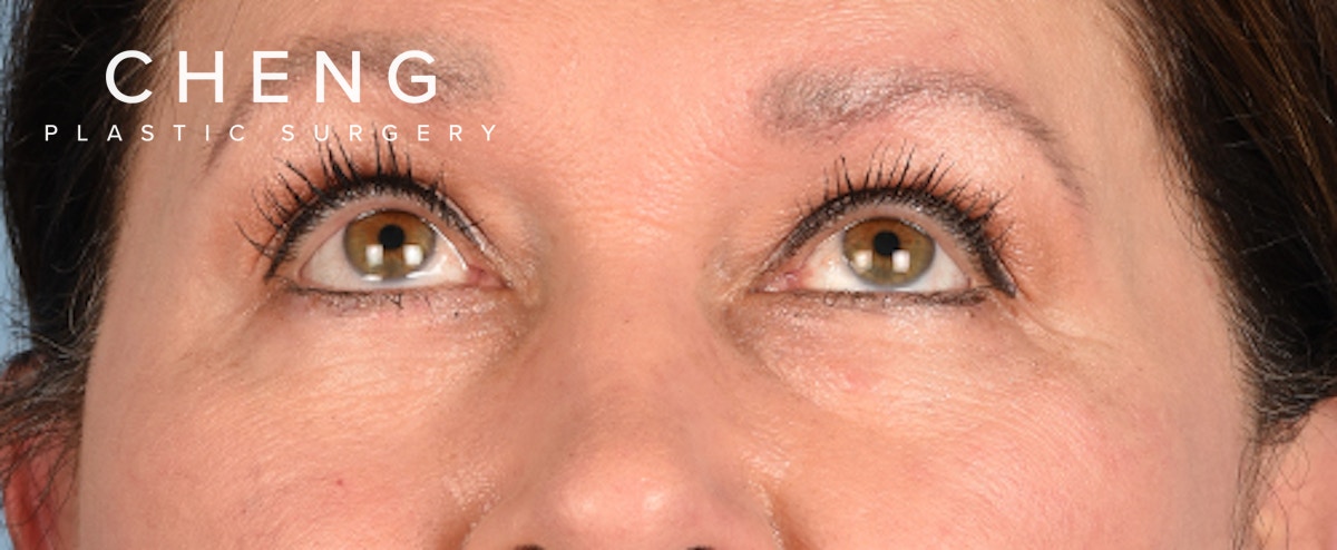 Hidden Patients Before & After Gallery - Patient 140219 - Image 3