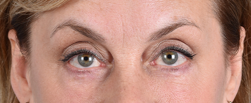 Hidden Patients Before & After Gallery - Patient 561726 - Image 2