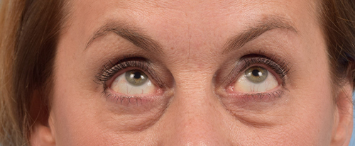 Hidden Patients Before & After Gallery - Patient 561726 - Image 3