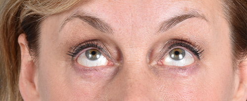 Hidden Patients Before & After Gallery - Patient 561726 - Image 4