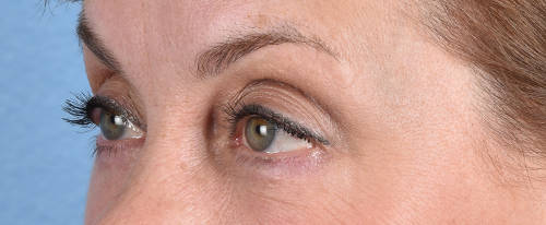 Hidden Patients Before & After Gallery - Patient 561726 - Image 6