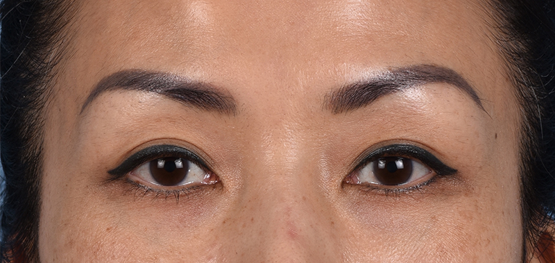 Hidden Patients Before & After Gallery - Patient 109685 - Image 1