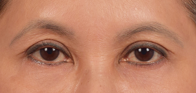 Hidden Patients Before & After Gallery - Patient 610926 - Image 2