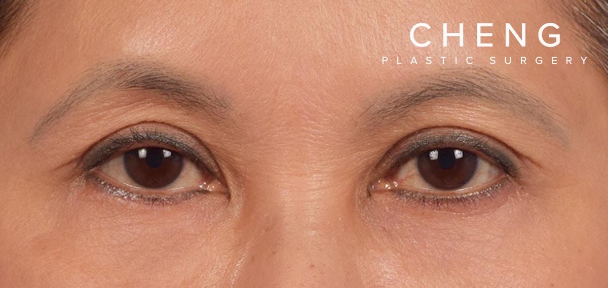 Hidden Patients Before & After Gallery - Patient 610926 - Image 2