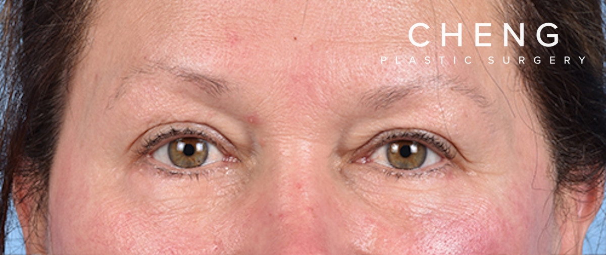 Hidden Patients Before & After Gallery - Patient 821760 - Image 2