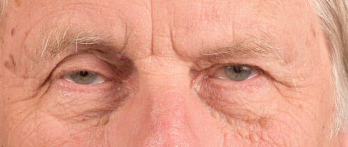 Hidden Patients Before & After Gallery - Patient 146304 - Image 1