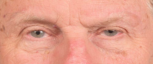 Hidden Patients Before & After Gallery - Patient 146304 - Image 2