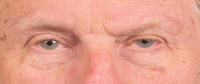 Hidden Patients Before & After Gallery - Patient 146304 - Image 2
