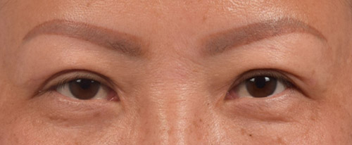 Hidden Patients Before & After Gallery - Patient 127674 - Image 2