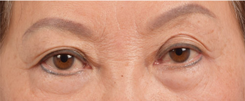 Hidden Patients Before & After Gallery - Patient 145659 - Image 1