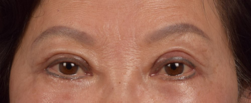 Hidden Patients Before & After Gallery - Patient 145659 - Image 2