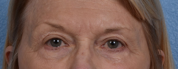 Hidden Patients Before & After Gallery - Patient 288598 - Image 2