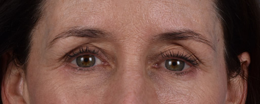 Hidden Patients Before & After Gallery - Patient 440219 - Image 2