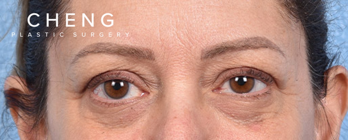 Hidden Patients Before & After Gallery - Patient 270778 - Image 1