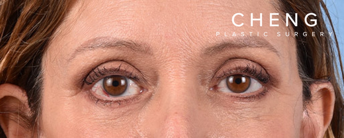 Hidden Patients Before & After Gallery - Patient 270778 - Image 2