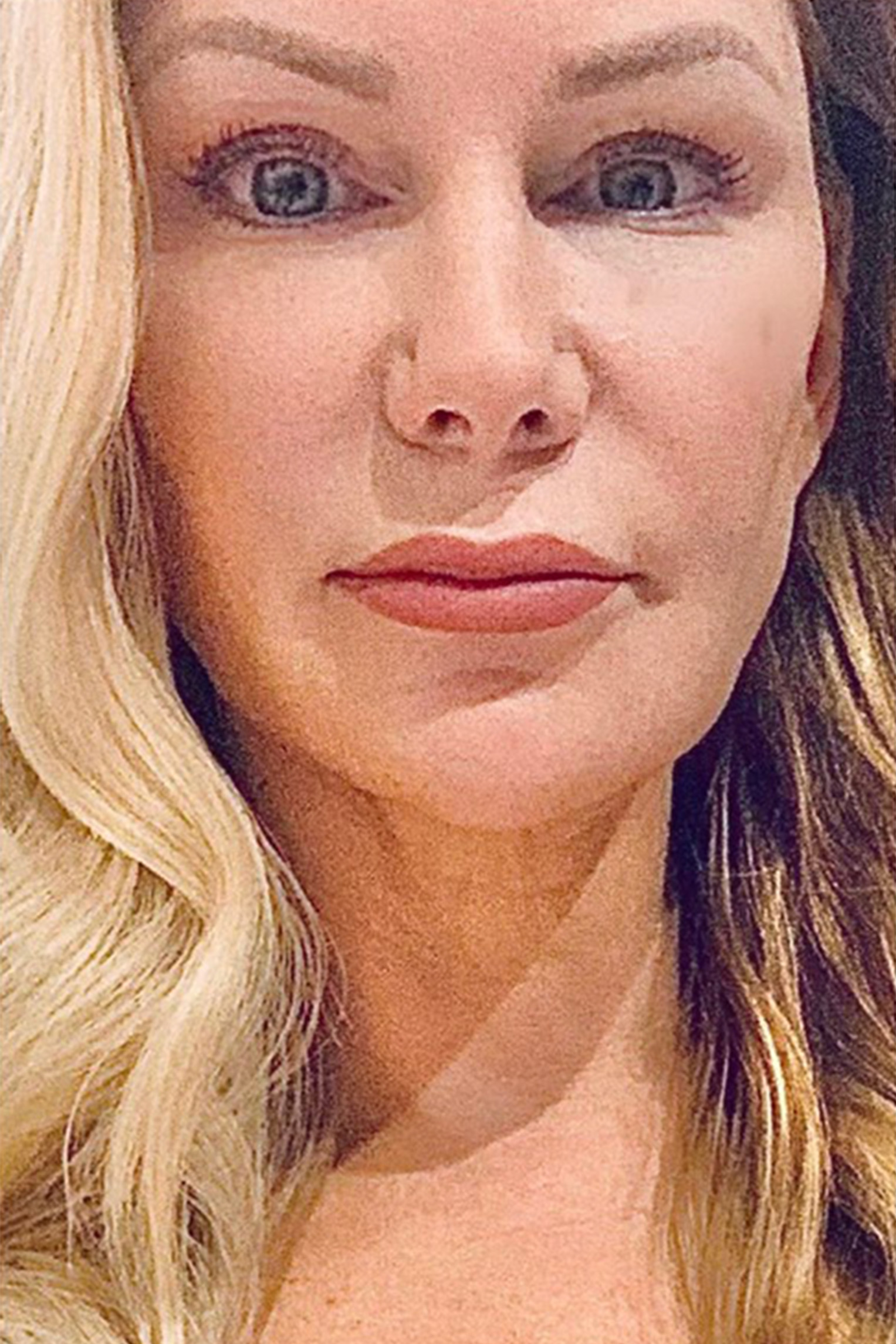 Hidden Patients Before & After Gallery - Patient 402708 - Image 3