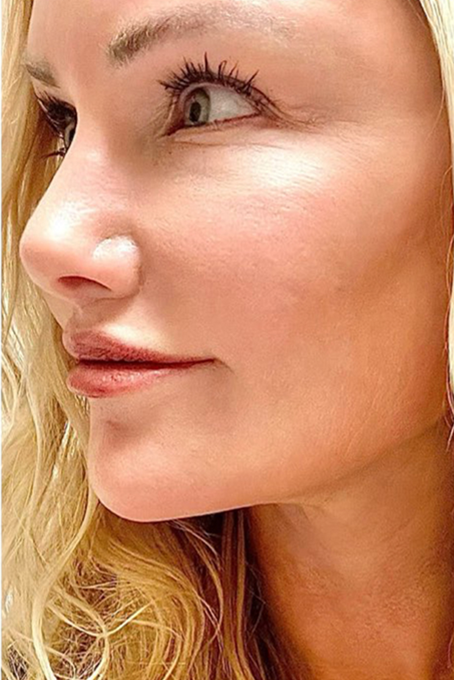 Hidden Patients Before & After Gallery - Patient 402708 - Image 6