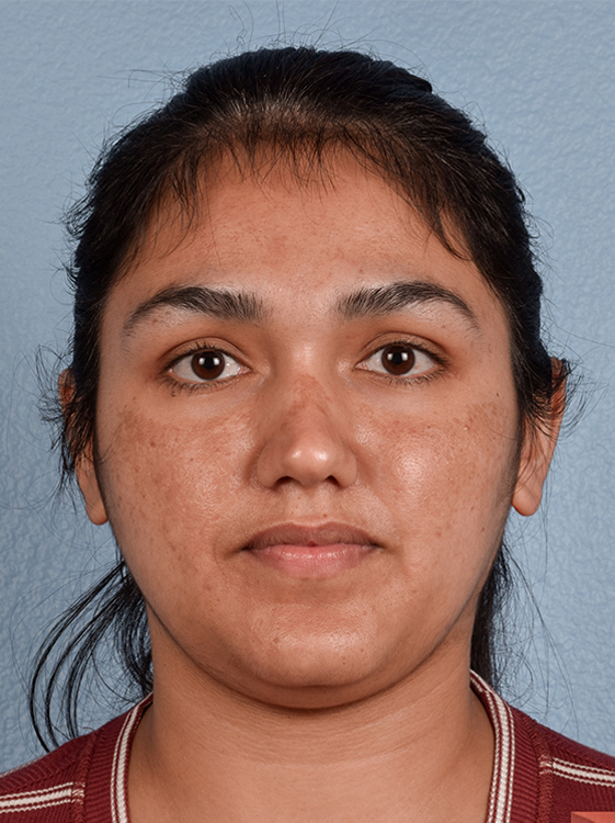 Skincare Before & After Gallery - Patient 418289 - Image 1