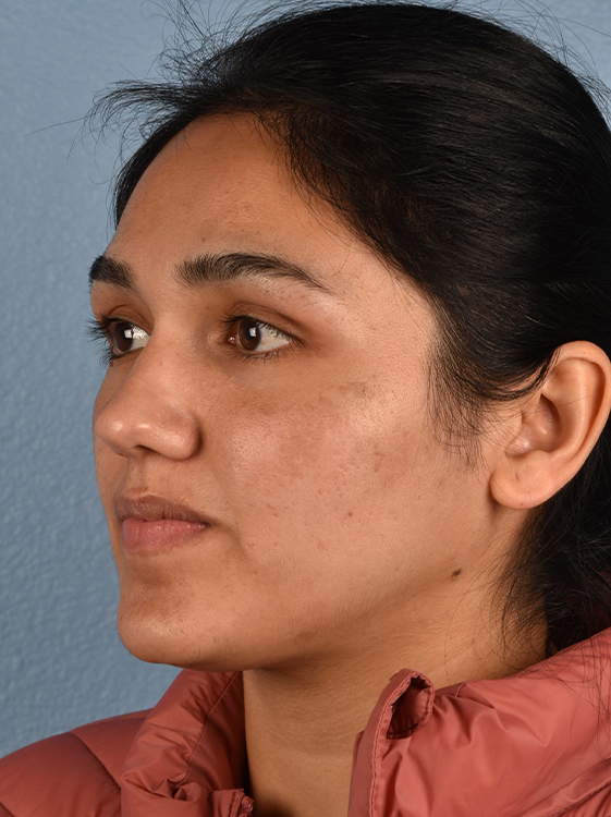 Skincare Before & After Gallery - Patient 418289 - Image 4