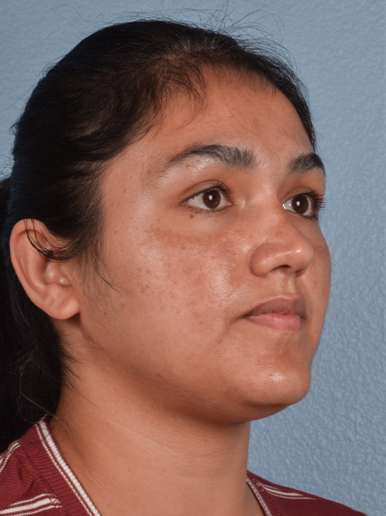 Skincare Before & After Gallery - Patient 418289 - Image 5