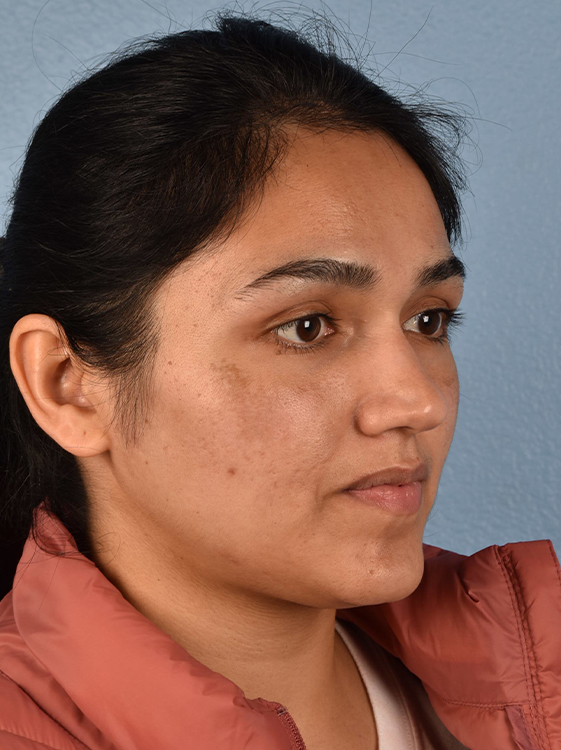 Skincare Before & After Gallery - Patient 418289 - Image 6